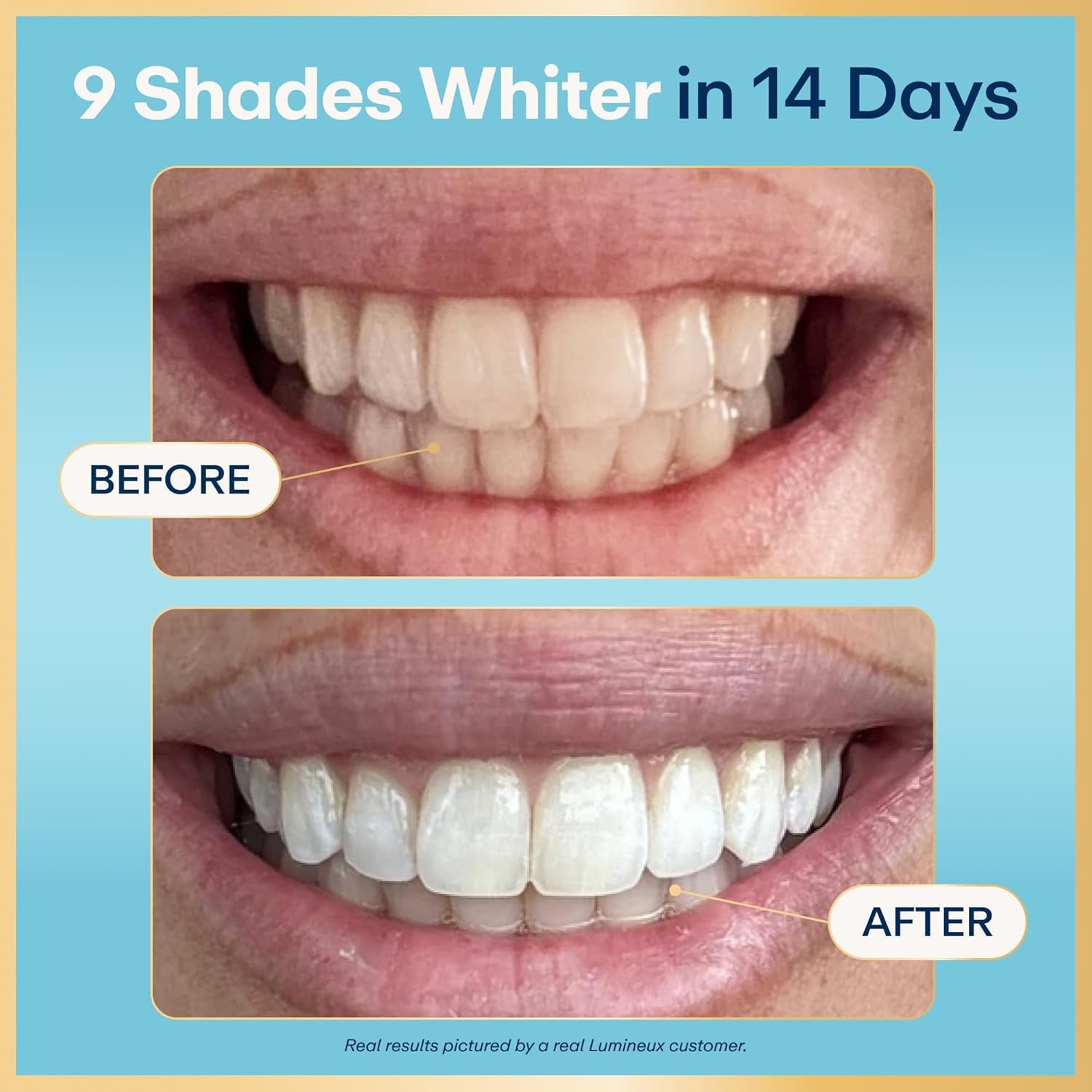 Teeth Whitening Strips Kit - 9 Treatments (1 Month) - Peroxide Free - Enamel Safe for Whiter Teeth - Whitening without the Sensitivity - Dentist Formulated - Sensitivity Free